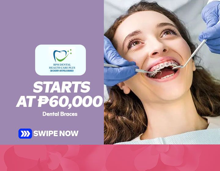 Dental Braces start at P60,000
