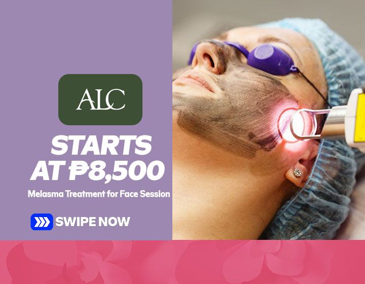 Melasma Treatment for Face starts at P8,500 per Session